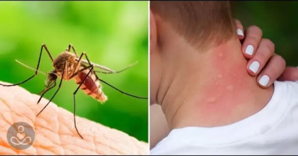 A Fever of Mosquitoes